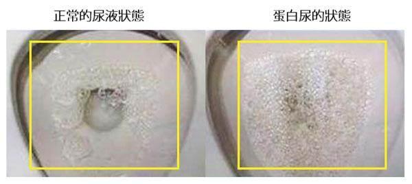 男人四十岁以后越来越“软”,睡前喝一杯它,让你越喝越来劲